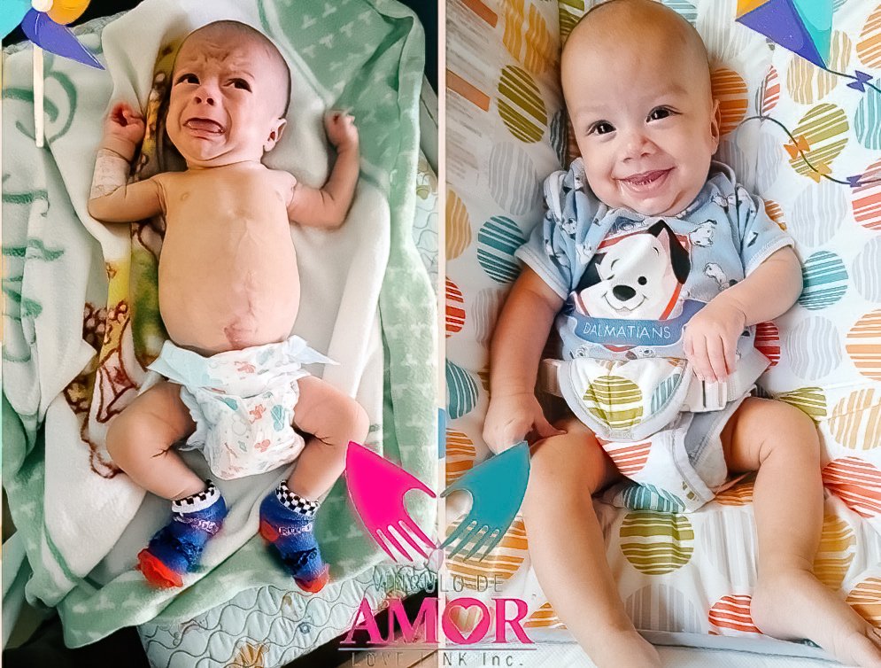 Every Gift Has a Story: Love Link (El Salvador)